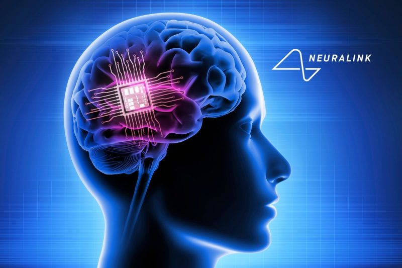 Can You Invest in Elon Musk’s Neuralink? (Updated 2024) Old American